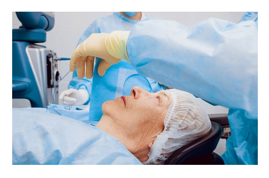 Katarakt Ameliyatı Bunama Riskini Azaltabilir..