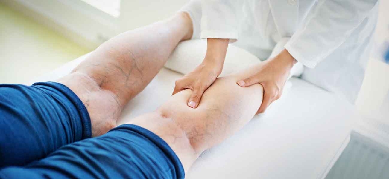 Diz Ağrıları ve Diz Çevresi Yağlanmanın Arkasında Lipödem Olabilir