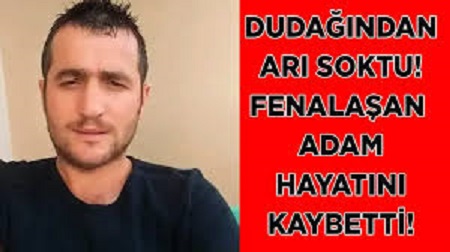  Artvin’in Borçka ilçesinde dudağını arı sokan kişi, kaldırıldığı hastanede hayatını kaybetti.
