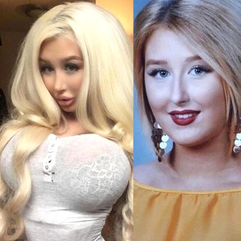 Barbie Bebeğe Benzemek İçin Estetik Olan Kadının Doğal Hali Daha Çok Beğenildi