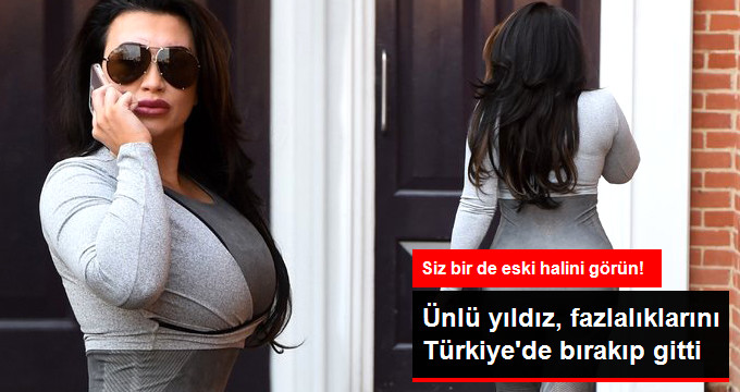 İngiliz TV Yıldızı, Fazla Yağlarını Türkiye'de Bırakıp Gitti