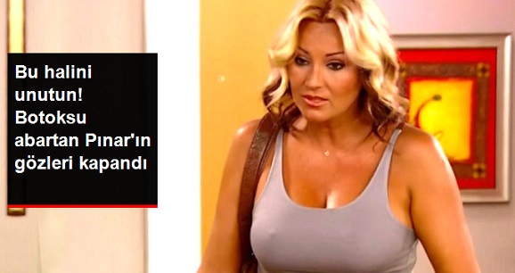 Pınar Altuğ'un Botokstan Neredeyse Gözleri Kapandı