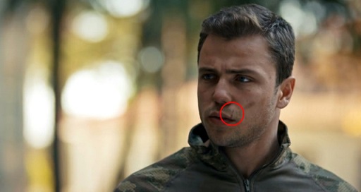 Yavuz Komutanı  köpek ısırdı